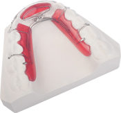 Modified-Spring-Retainer